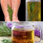 Naturally Banish Varicose Veins with Rosemary!